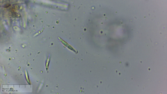 Incrucipulum ciliare