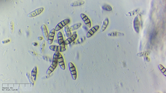 Melanomma pulvis-pyrius
