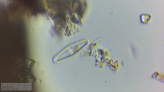 Planothidium lanceolatum