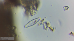 Planothidium lanceolatum