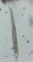 Spirostomum