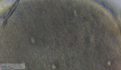 Ophryoglena