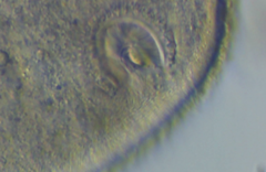Ophryoglena