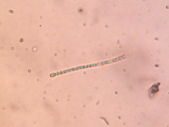 Cyanophyceae