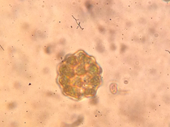 Coelastrum