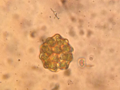 Coelastrum
