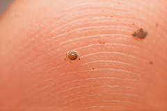 Pseudiotula eurysiana