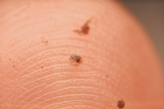 Pseudiotula eurysiana