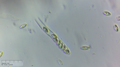 Ascocoryne lilacina
