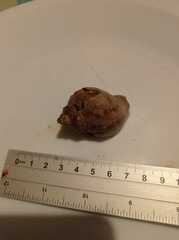 Stramonita biserialis