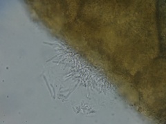 Hypomyces tremellicola