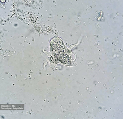 Amoebidae