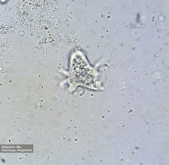 Amoebidae