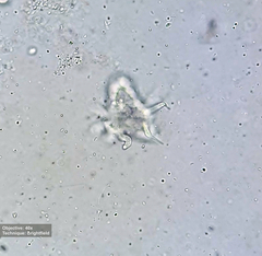Amoebidae