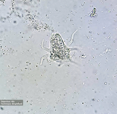 Amoebidae