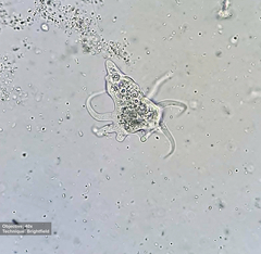 Amoebidae
