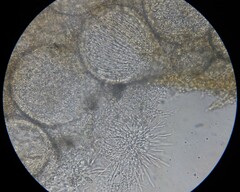 Hypomyces tremellicola