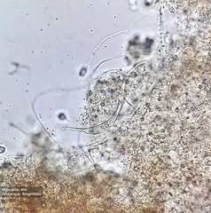 Pleurostomatida