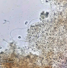Pleurostomatida