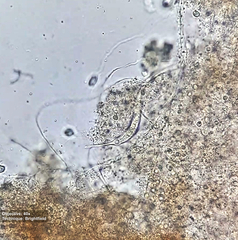 Pleurostomatida
