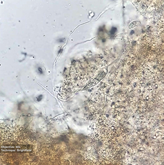 Pleurostomatida