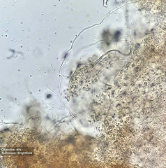 Pleurostomatida