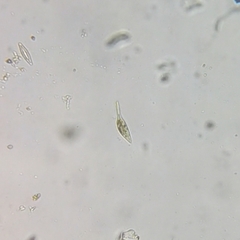 Litostomatea