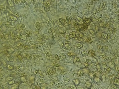 Phaeotremella