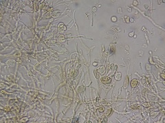 Phaeotremella