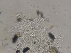 Rosellinia