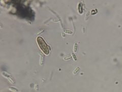 Rosellinia