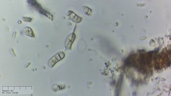 Dacrymyces lacrymalis