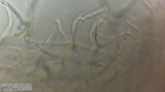 Dacrymyces lacrymalis