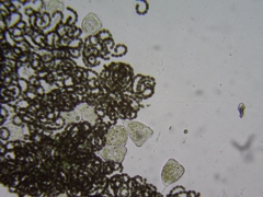 Dolichospermum lemmermannii