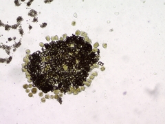 Dolichospermum lemmermannii