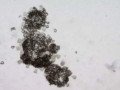 Dolichospermum lemmermannii