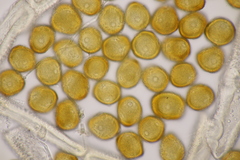 Gymnosporangium sabinae
