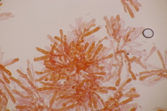 Basidiomycota