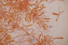 Basidiomycota
