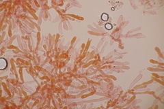Basidiomycota