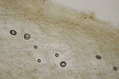 Basidiomycota