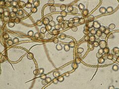 Trichia crateriformis