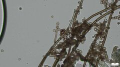 Trichaleurina tenuispora