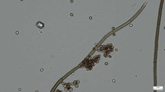 Trichaleurina tenuispora