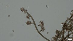 Trichaleurina tenuispora