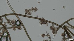 Trichaleurina tenuispora