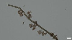 Trichaleurina tenuispora