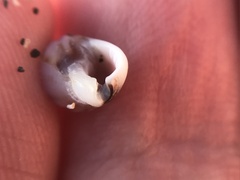Buccinoidea