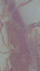 Acyrthosiphon