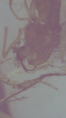 Acyrthosiphon